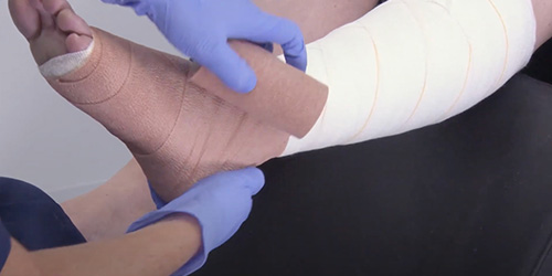 Play video: JOBST Comprifore Multi Layer Bandage Kit Play video: JOBST Comprifore Multi Layer Bandage Kit